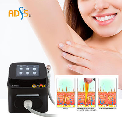 Dauerhafte Laser-Haar-Abbau-Eis-Maschine, 808 Dioden-Laser-Ausrüstung Soem/ODM