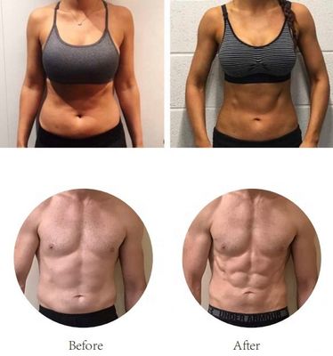 Eignungs-Maschine Soems EMS sculpt Ausrüstung, Cellulite und Fettabbau-Maschine
