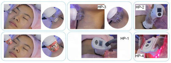 Face lifting VELA-SHAPE, das Hohlraumbildung Rf-Vakuumkörper-Maschine der Maschinen-2000W abnimmt