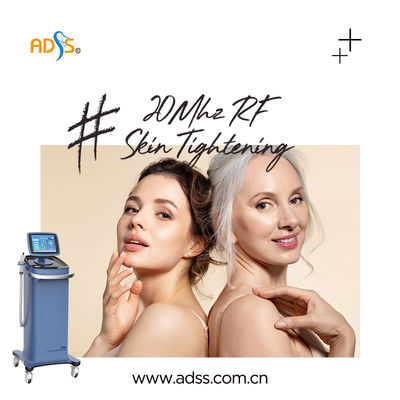 Haut, die Thermage Rf-Maschine 20MHz für Werbung festzieht