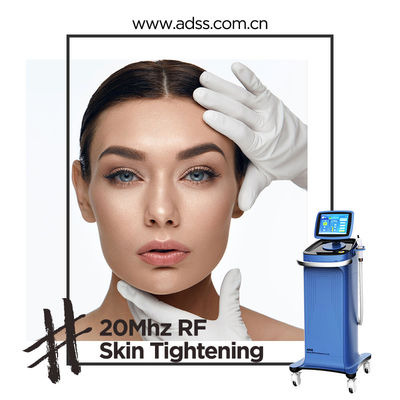 Späteste Thermage-Maschine, Ausrüstungs-Preis Rfs Thermage für Haut-Verjüngung