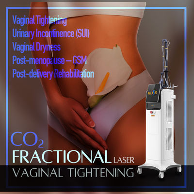 Ausdehnungs-Mark Removal Fractional-CO2 Laser-Maschinen-10.6um/10600nm Luftkühlung