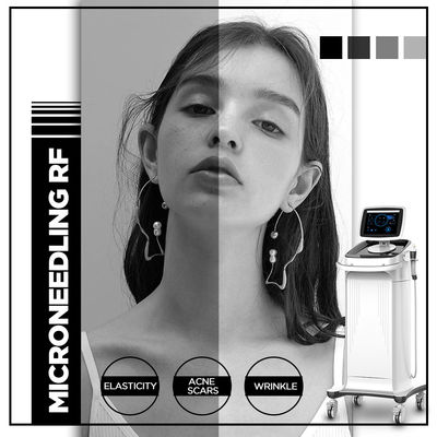 Hochfrequenz Microneedlings-Maschine, Thermolift-Maschine für Badekurort-Salon