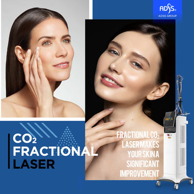 Bruch-CO2 10600nm Laser-Haut, die Maschine für Schönheits-Salon erneuert